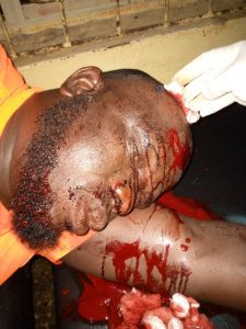 BONSUE, many injured as APC, ADC Supporters Clash
